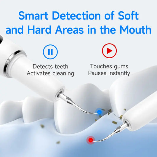 ORAVA Ultrasonic Plaque Remover – Professional Dental Cleaning Tool for At-Home Tartar & Plaque Removal