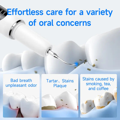 ORAVA Ultrasonic Plaque Remover – Professional Dental Cleaning Tool for At-Home Tartar & Plaque Removal