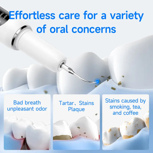ORAVA Ultrasonic Plaque Remover – Professional Dental Cleaning Tool for At-Home Tartar & Plaque Removal