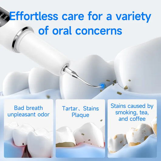 ORAVA Ultrasonic Plaque Remover – Professional Dental Cleaning Tool for At-Home Tartar & Plaque Removal